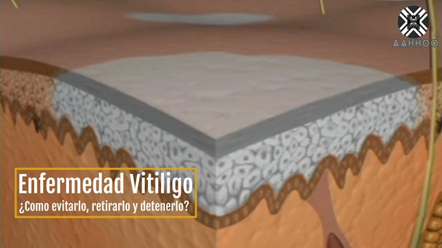 El protocolo Epi-control Vitiligo 2024