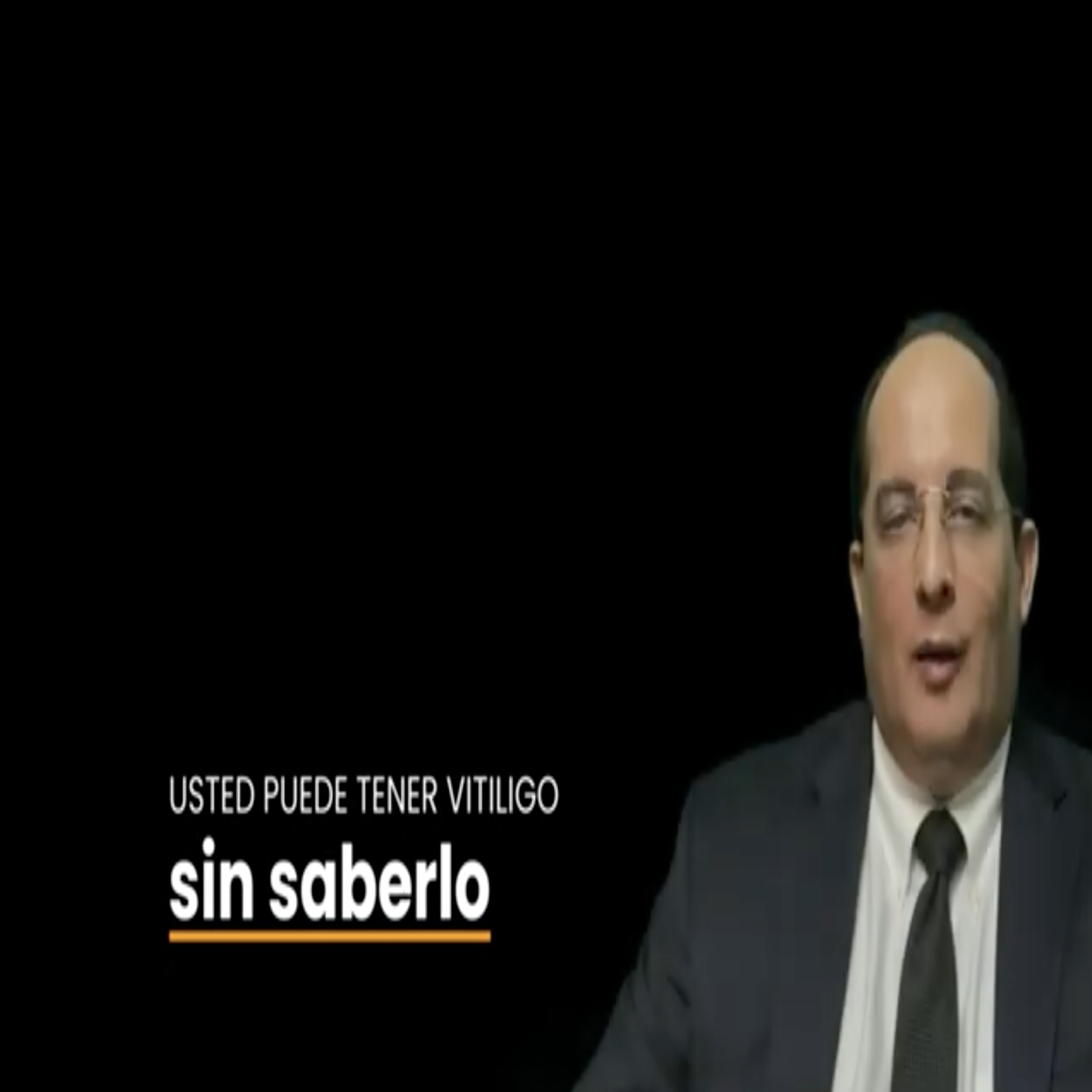 NMV: Temp. 1 Ep. 18 - Usted puede tener Vitiligo sin saberlo