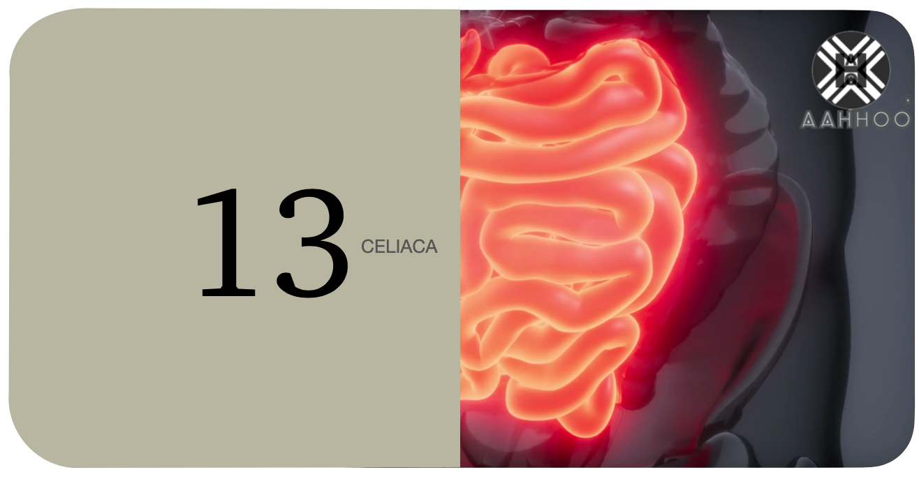 Celiaca 13