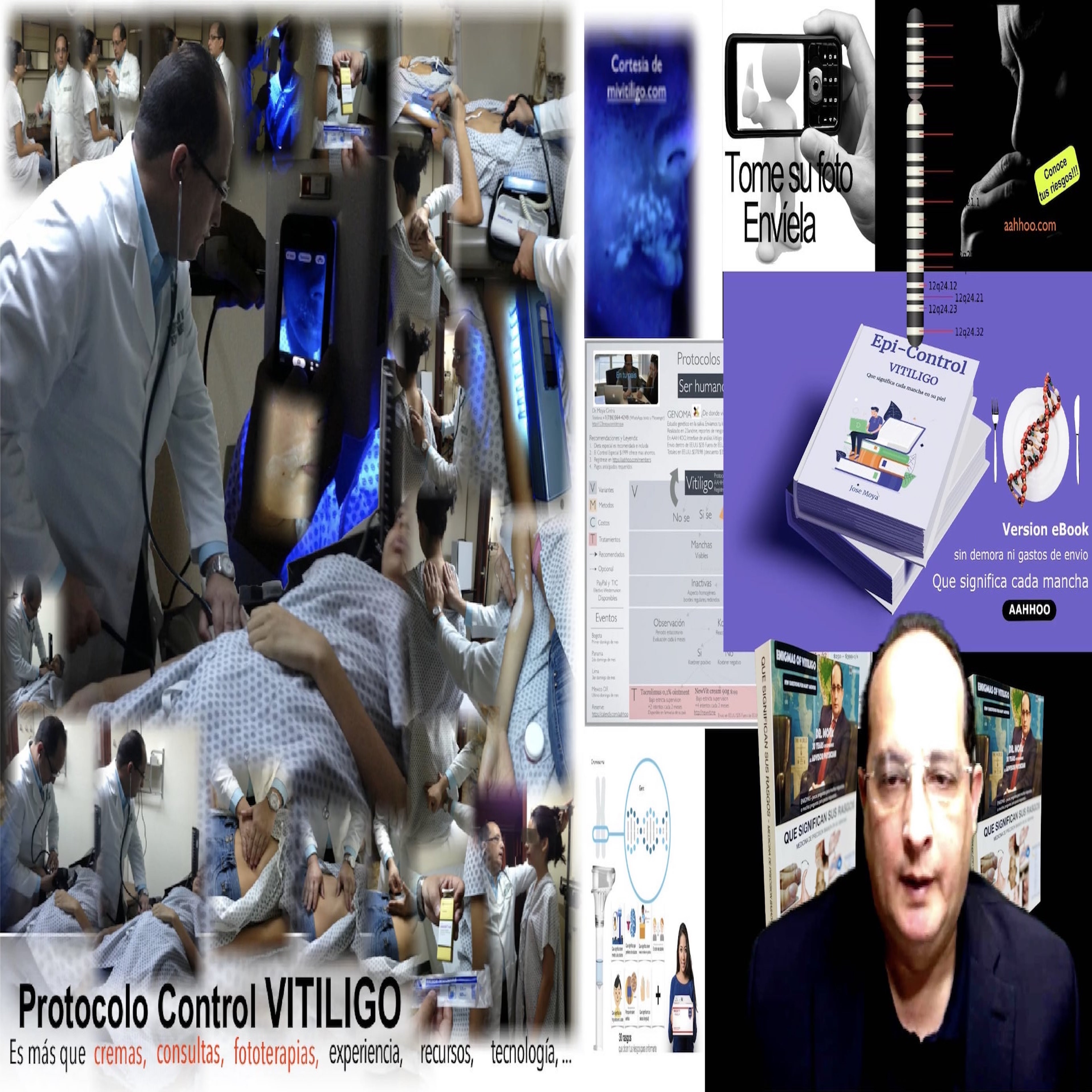 VITILIGO Epi-control videos