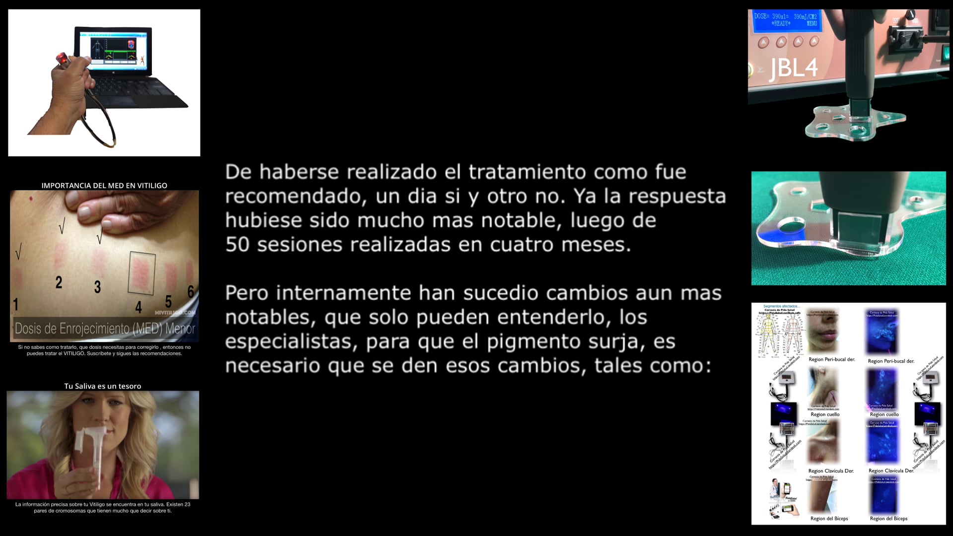 Protocolo Vitiligo. Disponible en tu pais