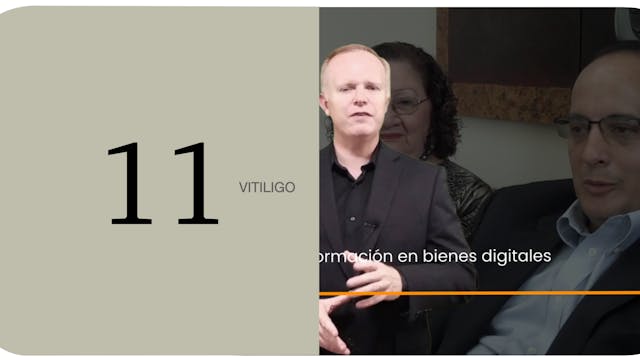Vitiligo 11