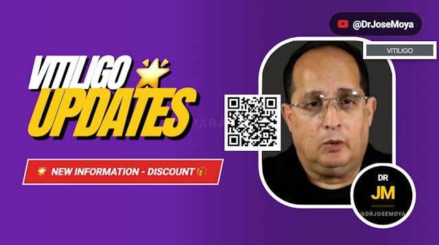 Vitiligo