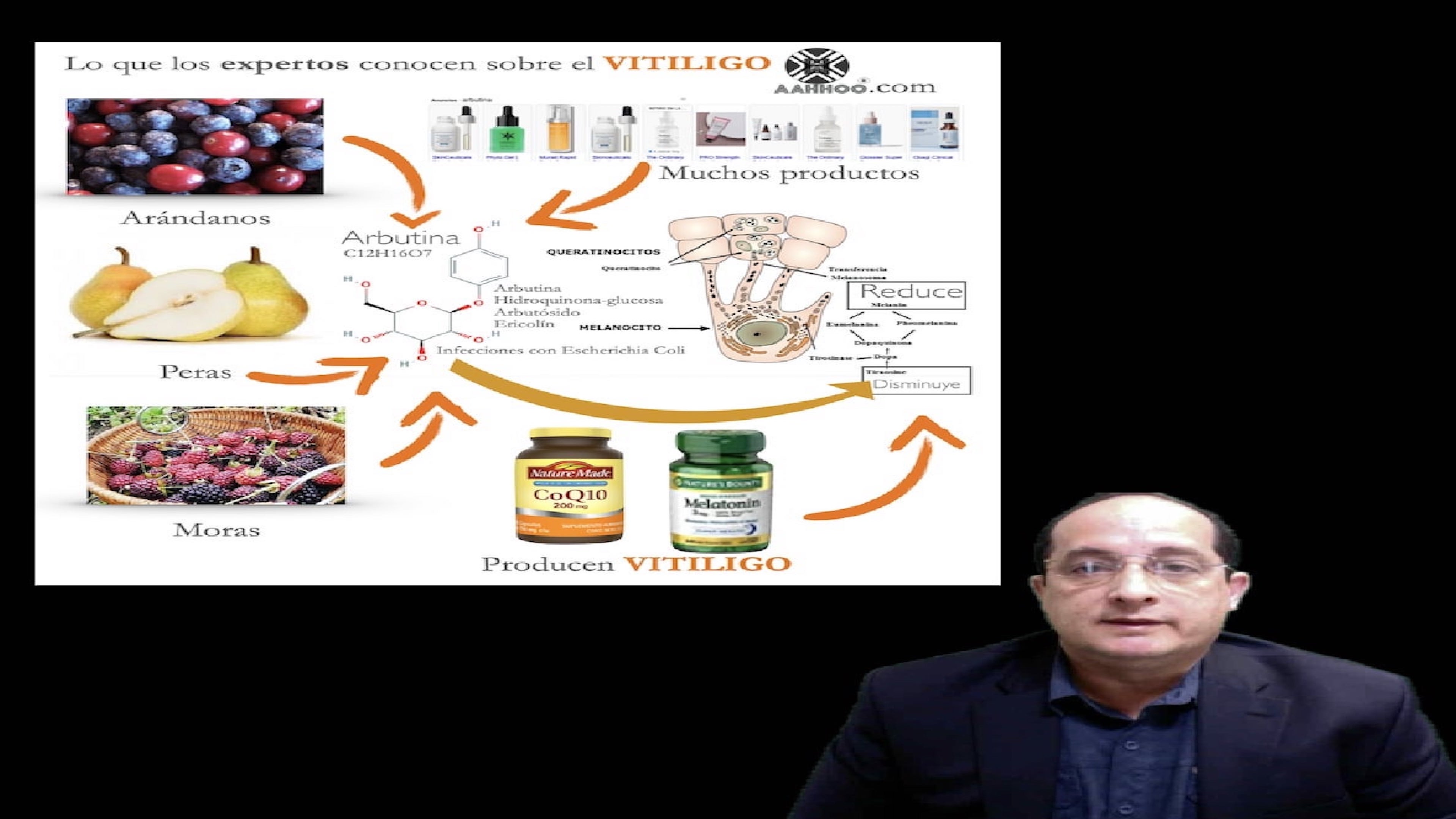 VITILIGO se puede EVITAR