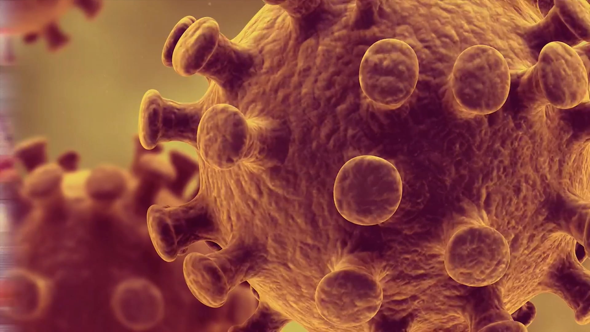 COVID-19 is killing us (English version)