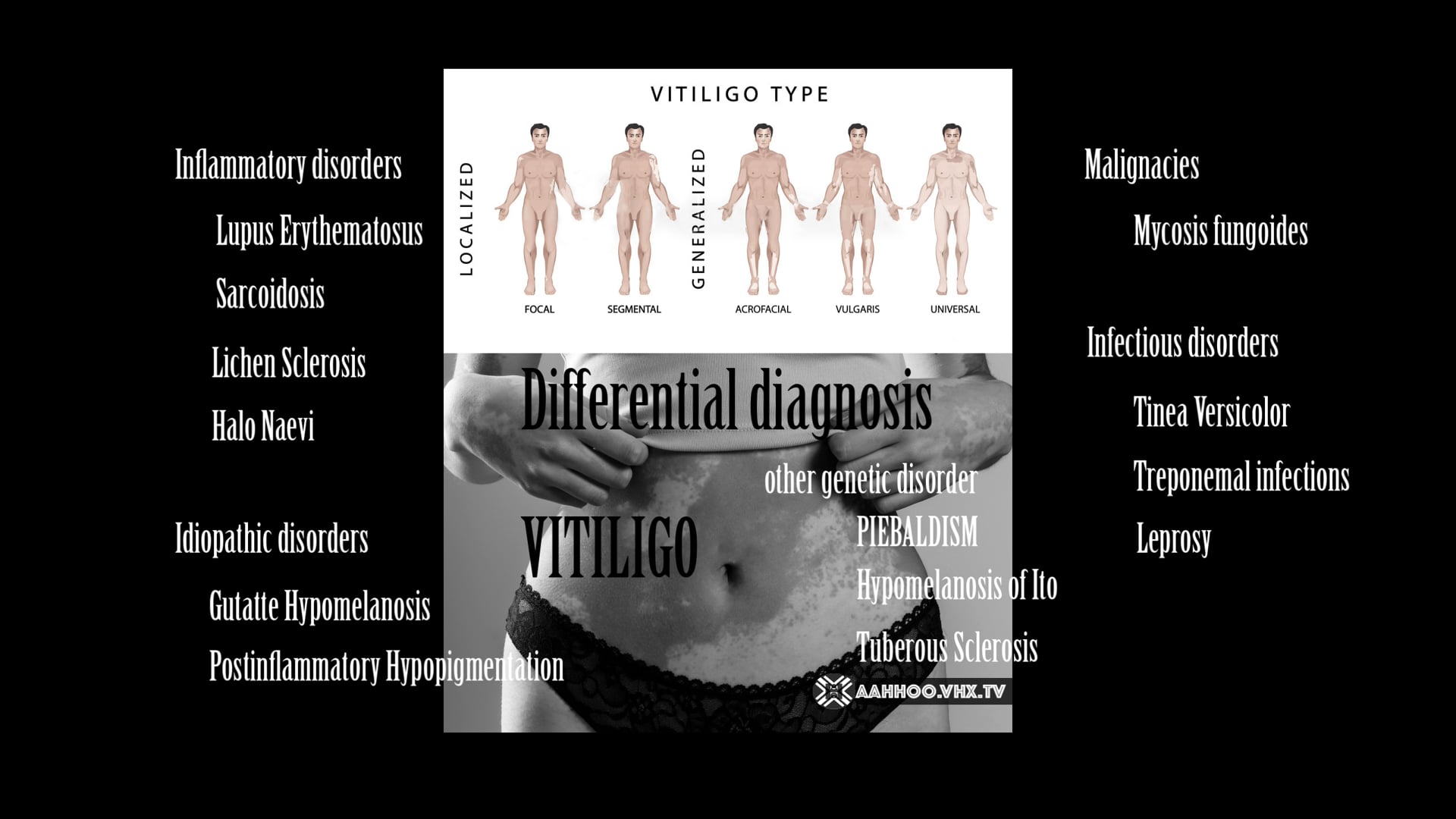 Differential Diagnosis Piebaldism