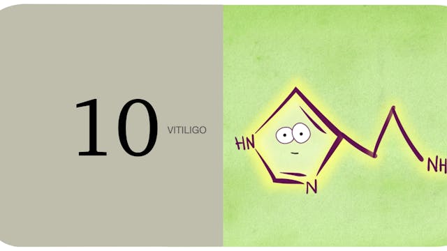 Vitiligo 10