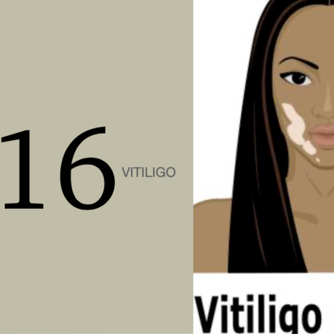 Proyecto Vitiligo
