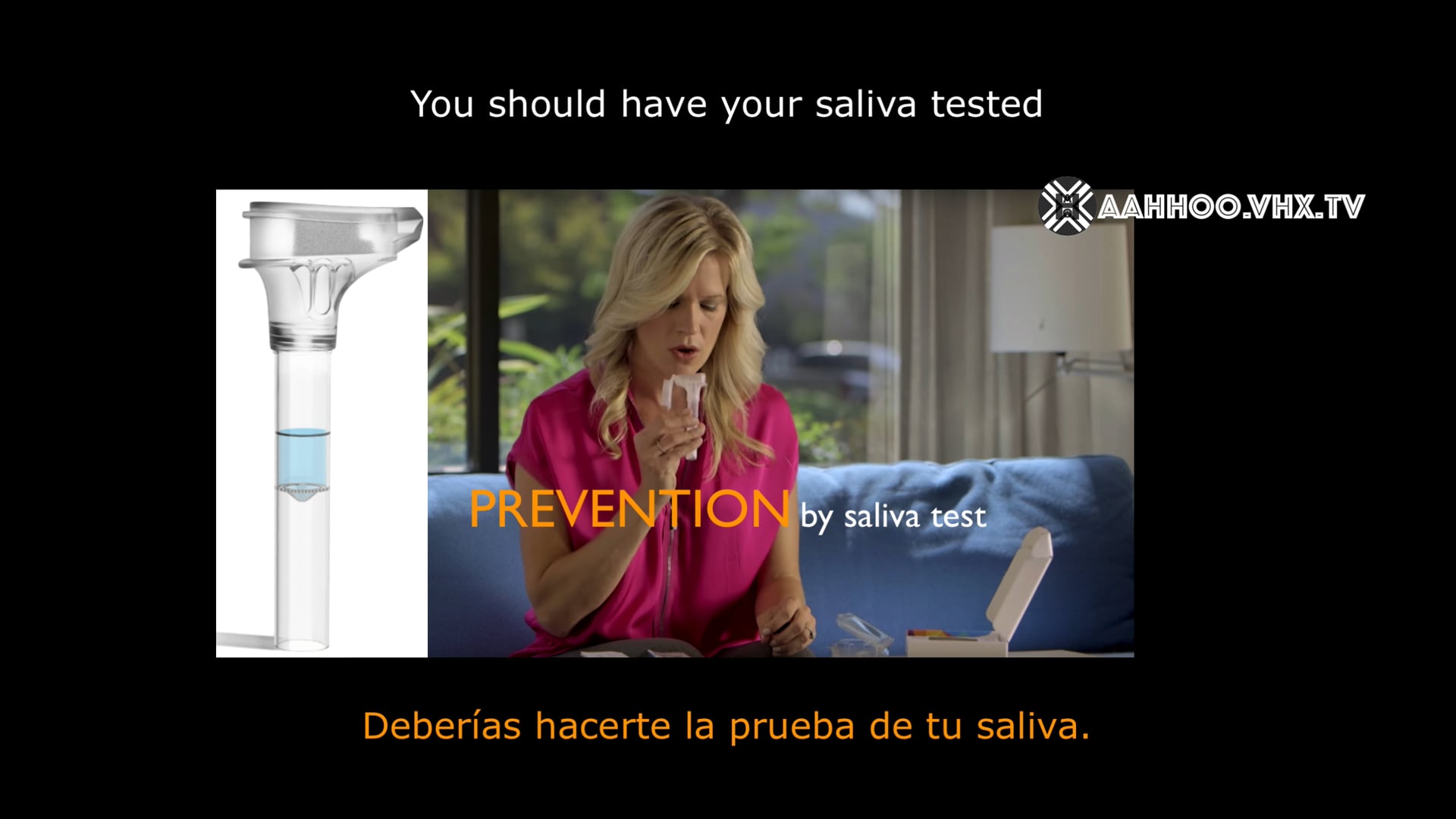 When Vitiligo is accompanied