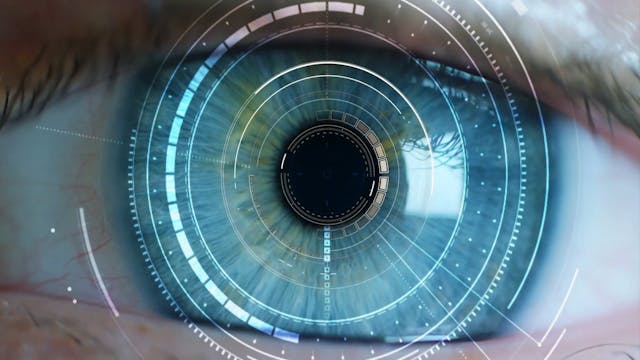 Blindness caused by Macular Degenerat...