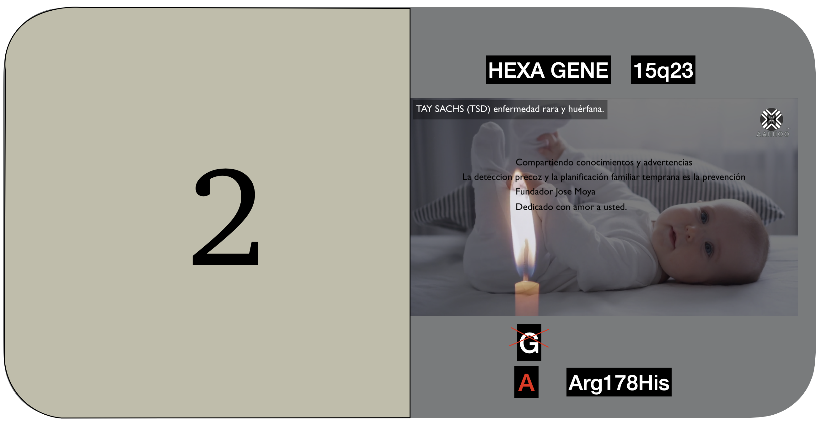 Tay Sachs (TSD) version español