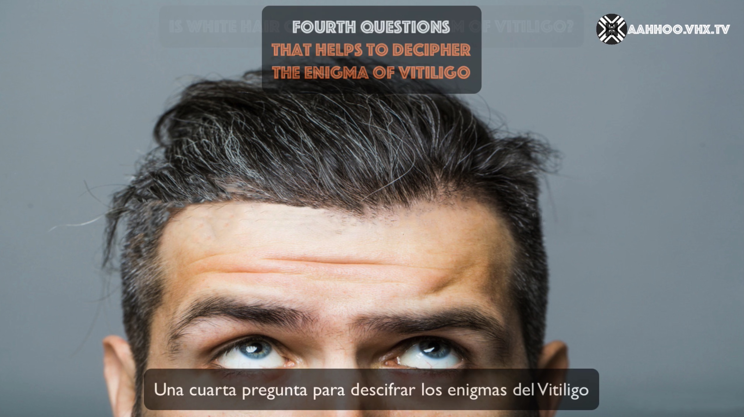 ENIGMAS OF VITILIGO Fourth question