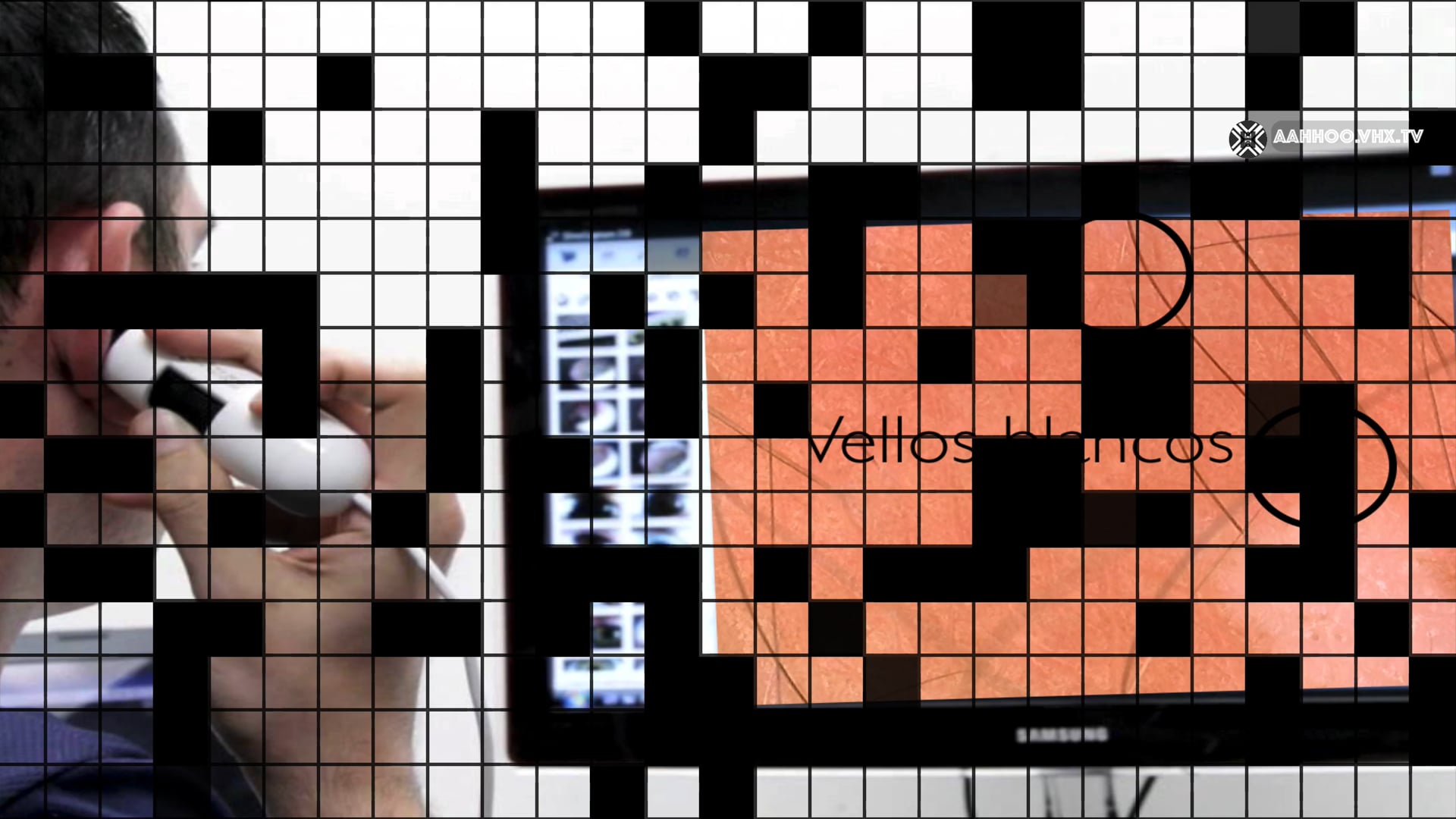 PROTOCOLO VITILIGO 2019