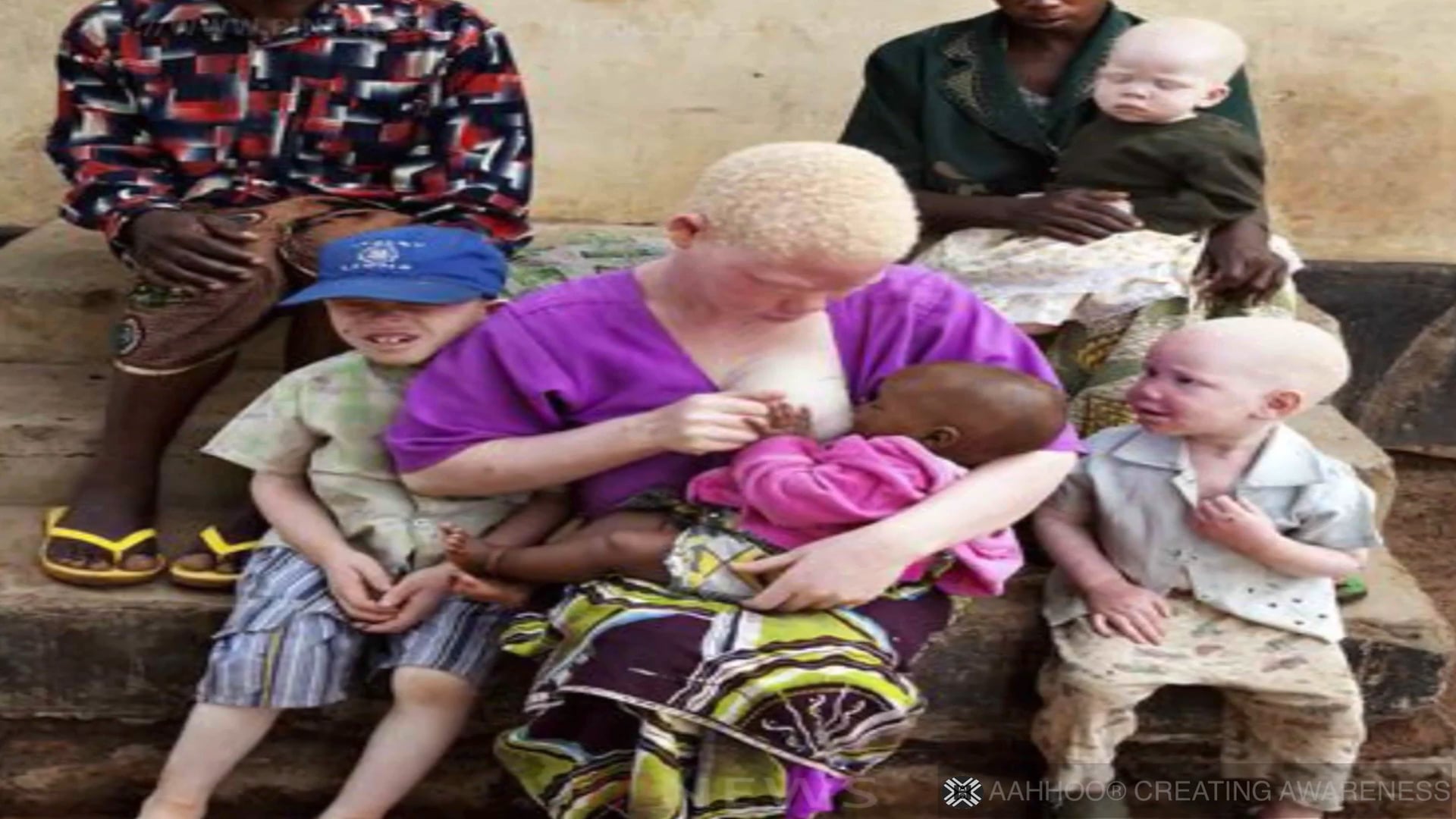 Albinos en Tanzania