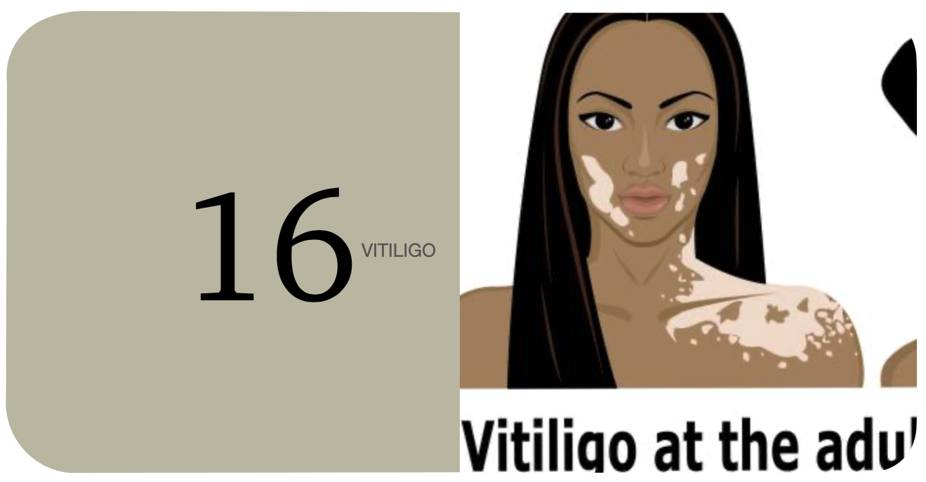 Proyecto Vitiligo