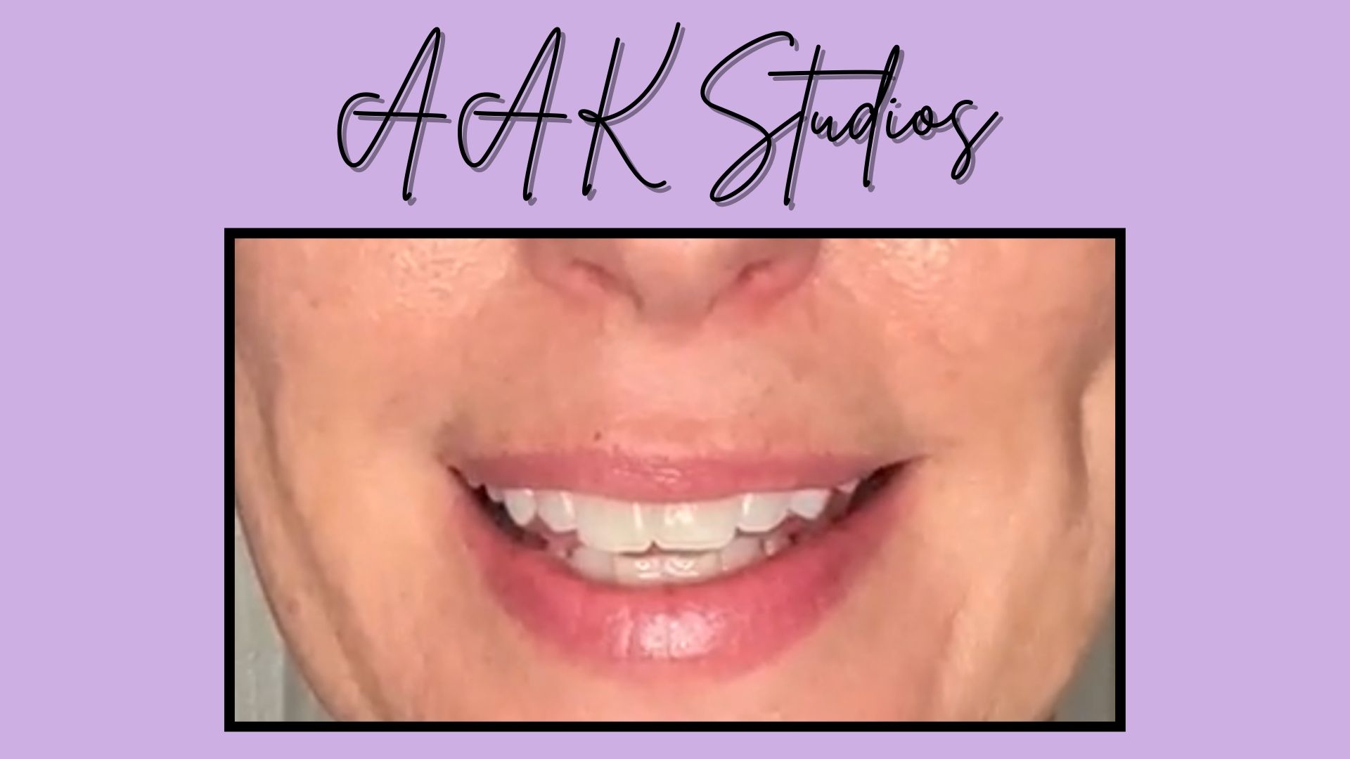 Vowel comparison: o / au / aw vs. oa / oe