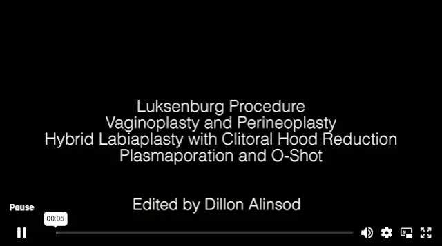 FellowsVid234 LN Luksenburg vp perine...