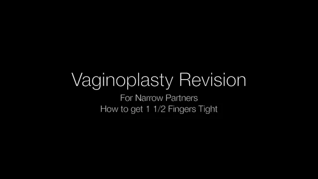 FellowsVid263LN Vaginoplasty Revision...