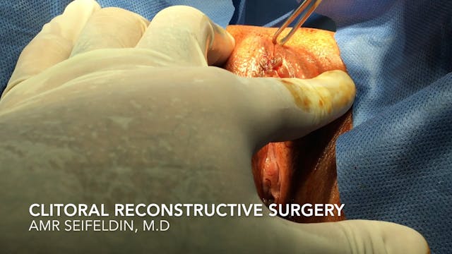 Clitoral Reconstructive Surgery - 3( Amr Seifeldin, M.D)