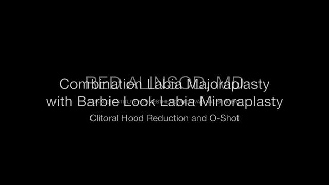 CORTOS – LP Combinada Minora-Majora c...