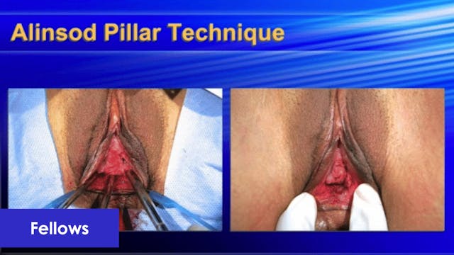 Hymenoplasty Lecture