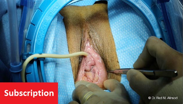Transvaginal Uterine Suspension: Pelv...