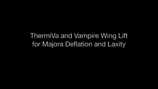LNNS6 Live Narrated ThermiVa and Vampire Wing Lift for Majora Deflation and Laxity Edit