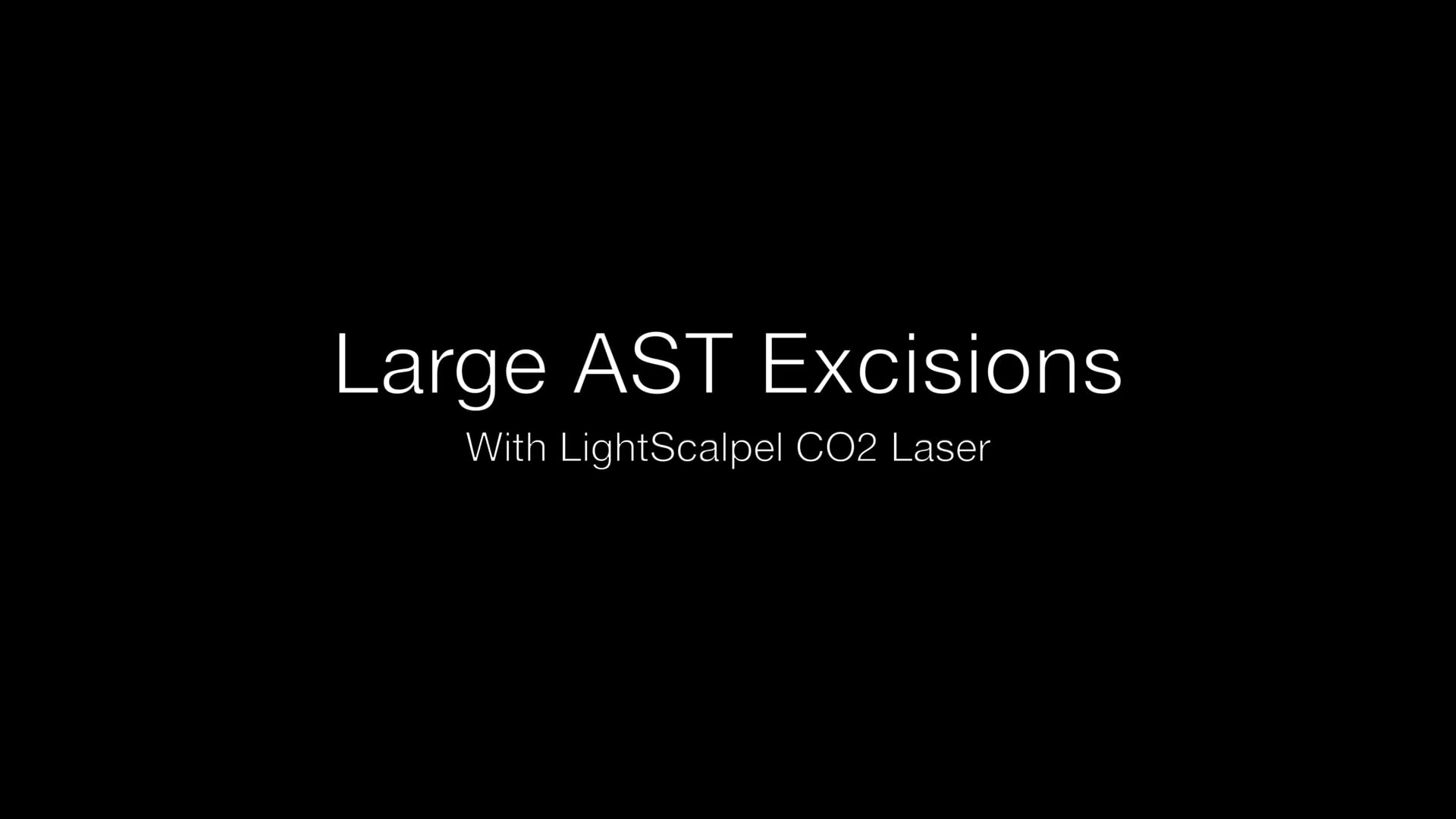 AIAVS Fellows Video 203, Live Narrated Large AST Excision with LightScalpel