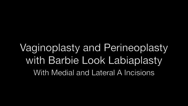 Perineoplastia, VP, Barbie LP y Incis...