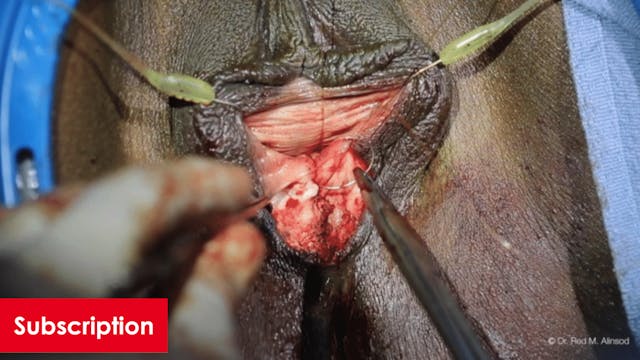 Vaginoplasty, Perineoplasty, and O-Shot