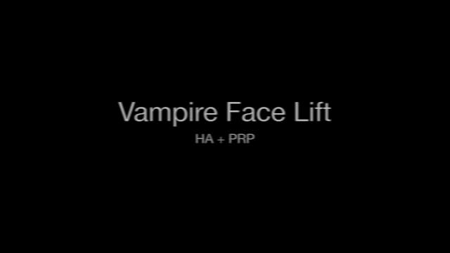 Vampire Face Lift by Sylvia Silvestri...