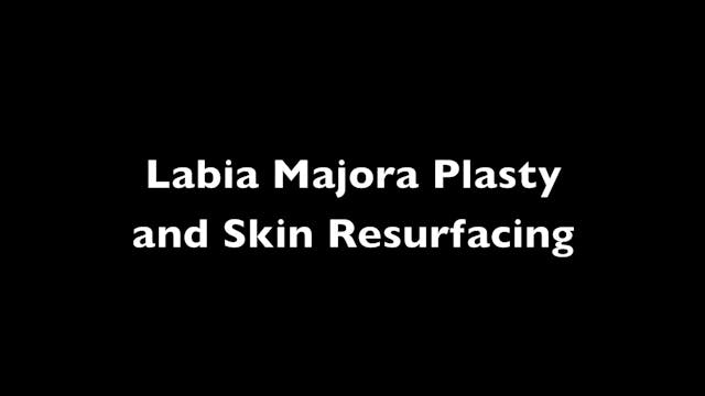 Labioplastia de Labios Mayores con Fe...