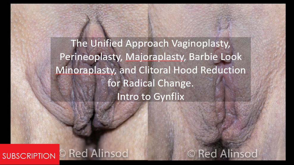 The Unified Approach Vaginoplasty, Perineoplasty, Majoraplasty