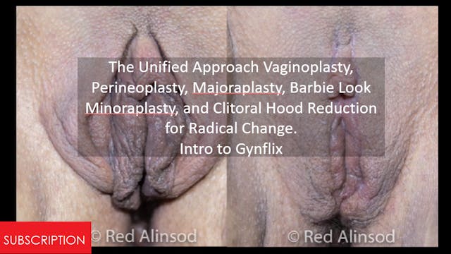 The Unified Approach Vaginoplasty, Pe...