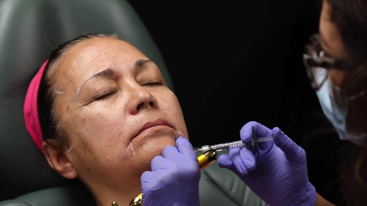 SHORTS: Vampire Face Lift by Sylvia Silvestri