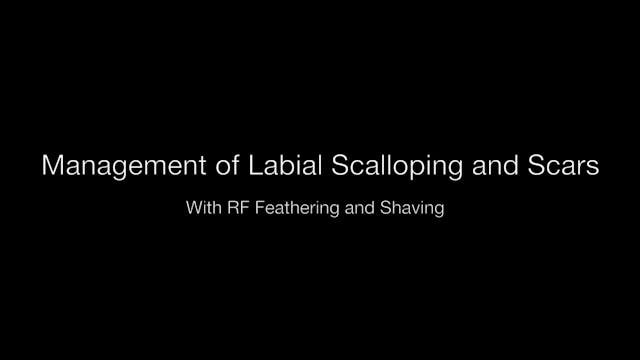 Management of Labial Scalloping and Scars with Feathering and Shaving