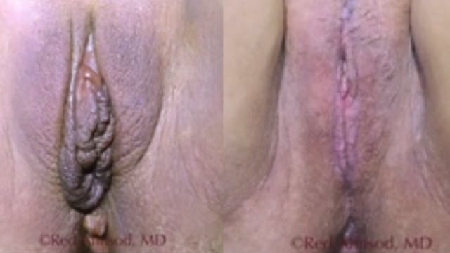 SHORTS: Perineo, Majora, Barbie LP, C...