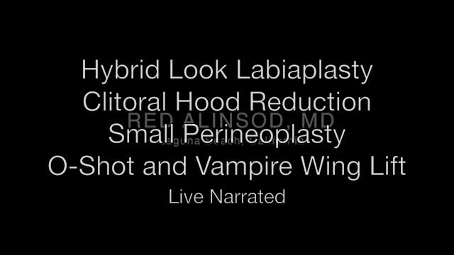 #24 – Barbie LP Híbrida, CHR, ThermiV...