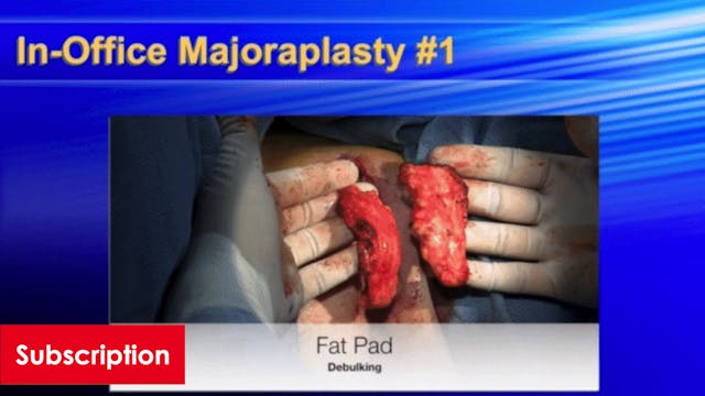 Labia Majoraplasty Lecture