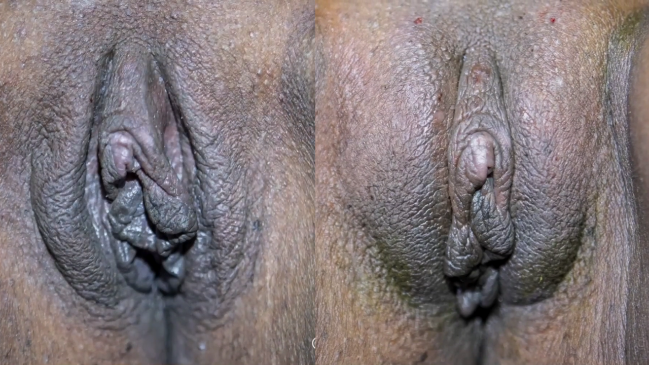 SHORTS: FemXHA for Vampire Wing LIft