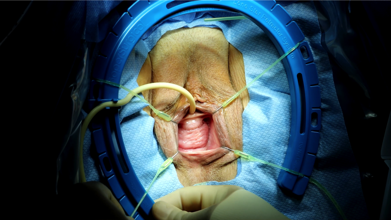 SHORTS: Caldera Desara TOT Sling by Red Alinsod