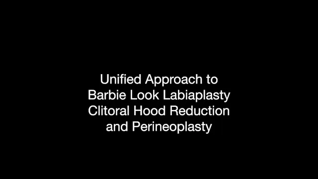 BNA 89 Before | After Barbie Labiapla...