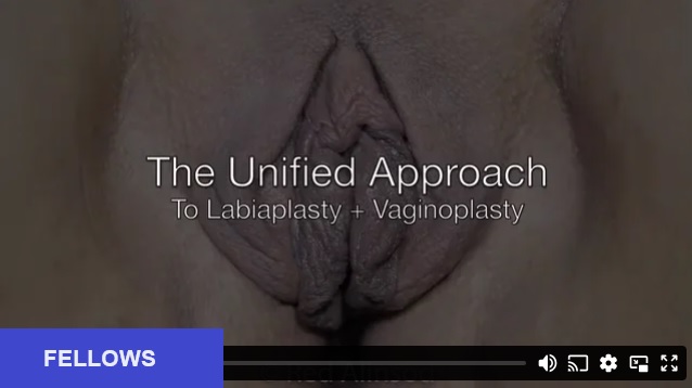 Unified Approach to Vaginoplasty and Labiaplasty - Summary