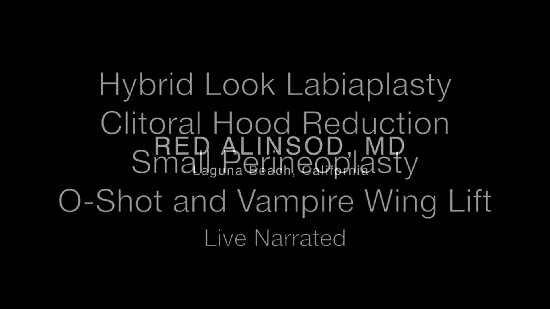 Labioplastia híbrida + reducción capuchón, ThermiVa y O-Shot