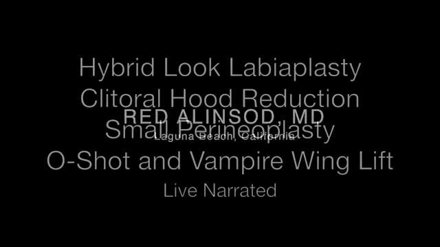 Labioplastia híbrida + reducción capu...