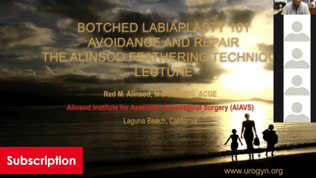 Botched Labiaplasty 101: Avoidance and Repair | The Alinsod Feathering Technique