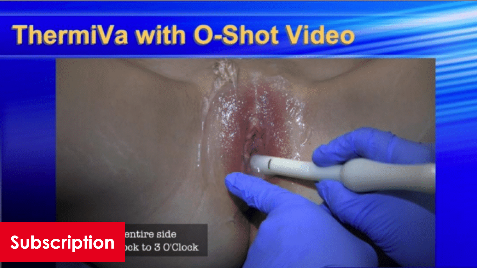 ThermiVa for Gynecology