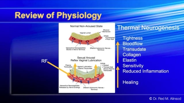 Synergy of Energy and Biologics: Thermi-O