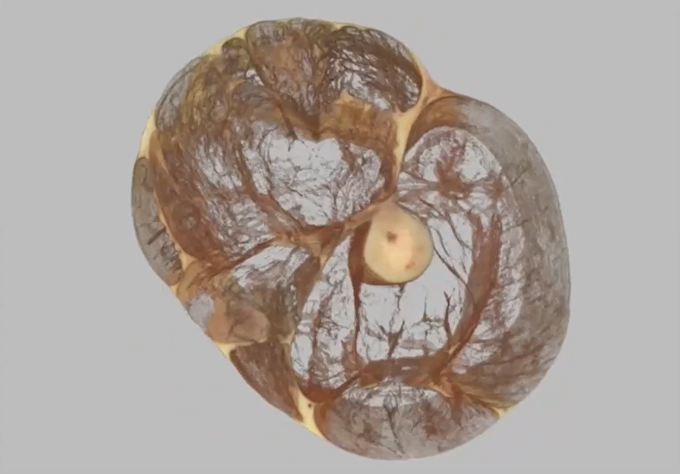 ATS&F Module 2: Tensegrity and BodyReading