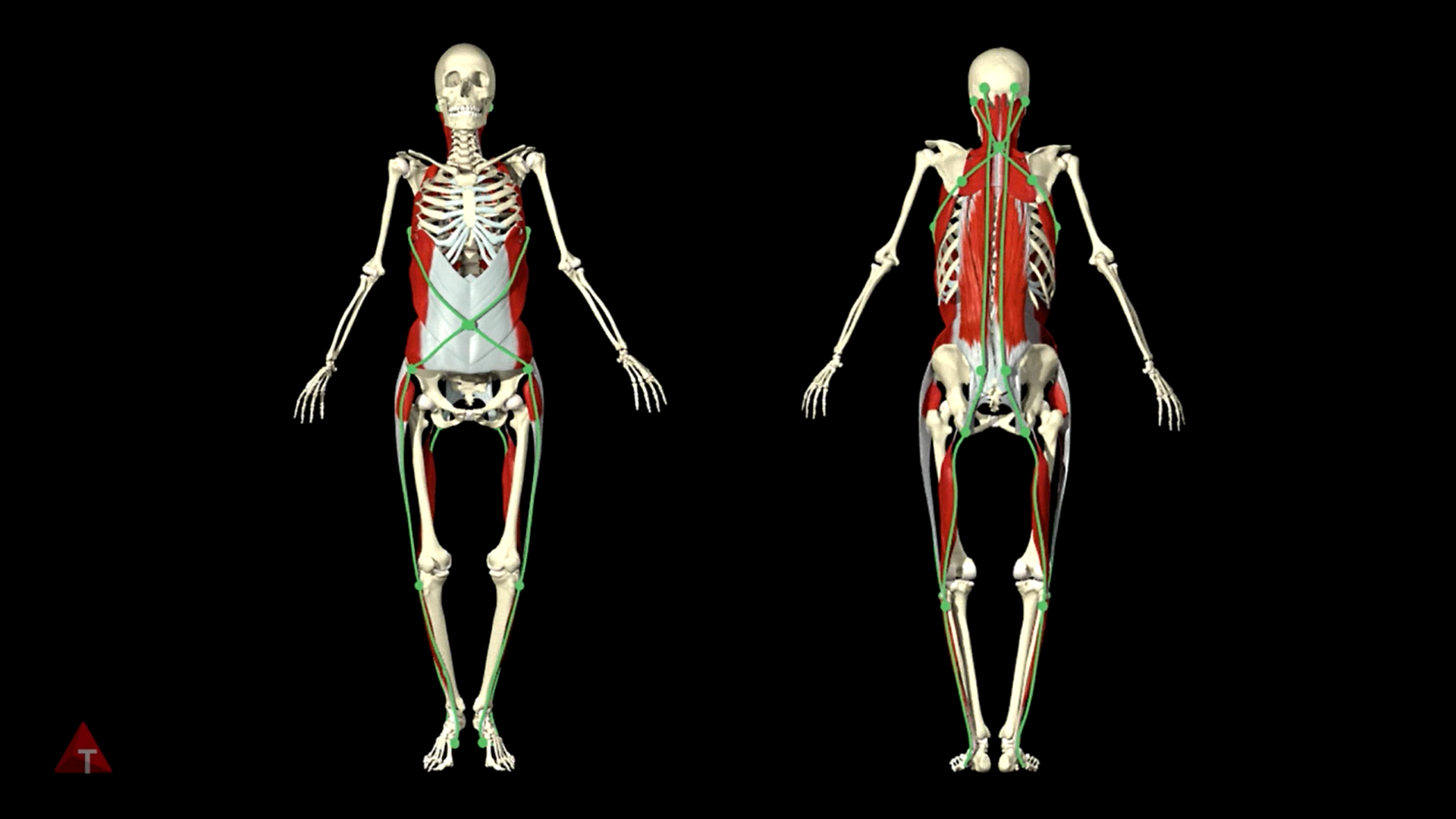 Dissection Lines on Skeleton - Lower Spiral Line Resected